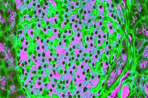 Un nuovo pancreas nel midollo osseo